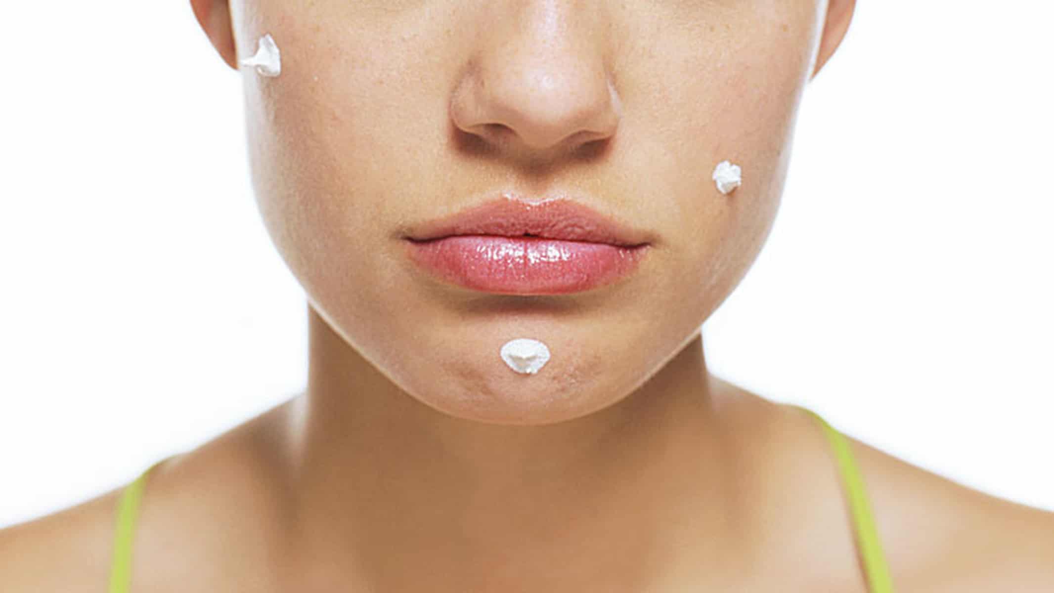 Ideas on how to clear up acne Finned Tubes